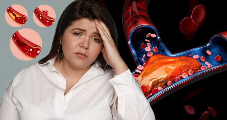 probleme supraponderabilitate