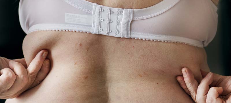 tratament-impotriva-celulitei